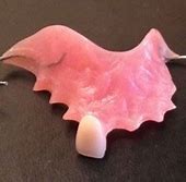 Image result for What Is a Dental Flipper Tooth