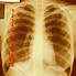 Image result for Numbered Diagram of Human Ribs
