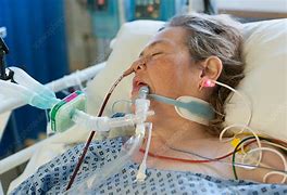 Image result for Woman On Ventilator