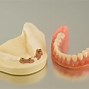 Image result for Over Teeth Dentures