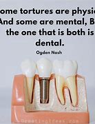 Image result for Dental Implant Quotes