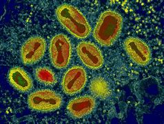 Image result for Pox Virus