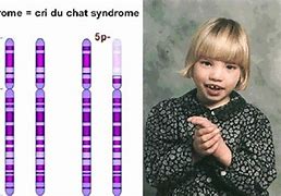 Image result for CRI Du Chat Adult
