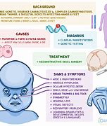 Image result for Pfeiffer Syndrome LL Cool J