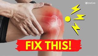 Image result for Clicking Knees Causes