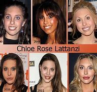 Image result for Chloe Lattanzi Before Plastic Surgery