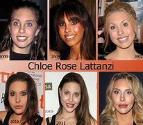 Image result for Chloe Rose Lattanzi Before Plastic Surgery