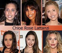 Image result for Chloe Lattanzi Surgery