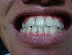 Image result for New Way to Clean Teeth