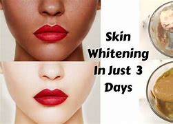 Image result for Fast Skin Whitening