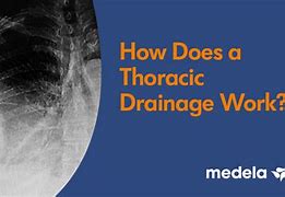 Image result for Thoracic Drainage