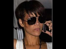 Image result for Rihanna Bruises