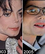 Image result for Michael Jackson Nose at Time of Death