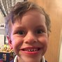 Image result for W.W. Williams Syndrome
