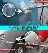 Image result for Roth Dent Removal Tool