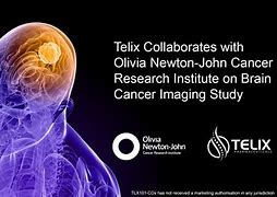 Image result for Olivia Newton-John Cancer Institute