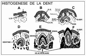 Image result for La Dent