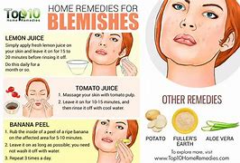 Image result for How to Get Rid of Skin Blemishes