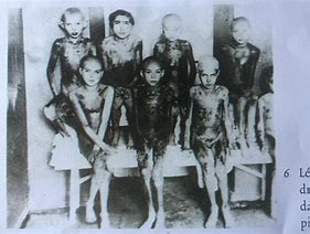 Image result for Josef Mengele Siamese Twins