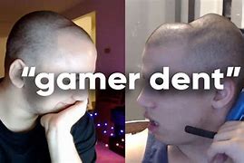 Image result for Gamer Skull Head Dent