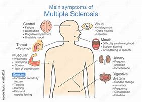 Image result for MS Symptoms Women