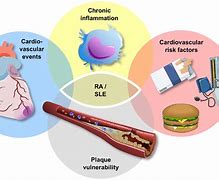 Image result for Atherosclerosis