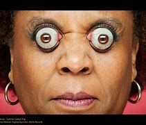 Image result for People with Weird Eyes