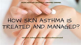 Image result for Skin Asthma Treatment