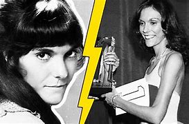 Image result for Karen Carpenter Anorexia Before After