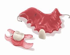 Image result for Flipper Tooth Replacement