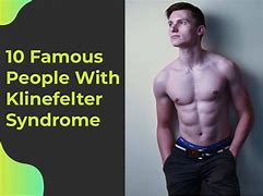 Image result for Famous People with Syndrome