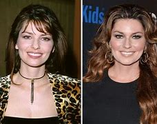 Image result for Shania Twain Face Change
