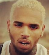Image result for Chris Brown Face After Fight