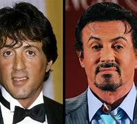 Image result for Sylvester Stallone Plastic Surgery Gone Bad