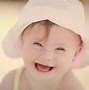 Image result for Down Syndrome Infant