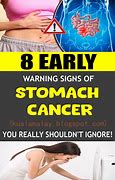 Image result for Stomach Cancer in Children