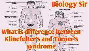 Image result for Women with Klinefelter's Syndrome