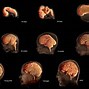 Image result for Adult Brain Development