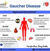 Image result for Gaucher S Disease What It Is