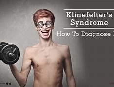 Image result for Klinefelter Syndrome Consiousness