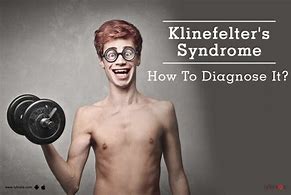 Image result for Understanding Klinefelter Syndrome