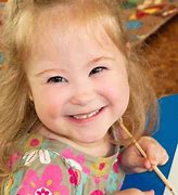 Image result for Angelman Syndrome Symptoms