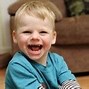 Image result for Symptoms of Angelman Syndrome