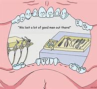 Image result for Dental Surgery Jokes