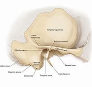 Image result for Mastoid Bone Behind Ear