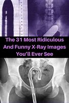 Image result for X-ray Funny Sayings