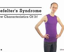 Image result for Klinefelter Syndrome Tall Stature