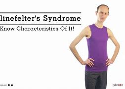 Image result for Signs and Symptoms of Klinefelter Syndrome