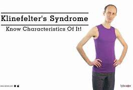 Image result for Klinefelter's Syndrome Characteristics