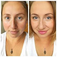 Image result for Arbonne Before and After Pics